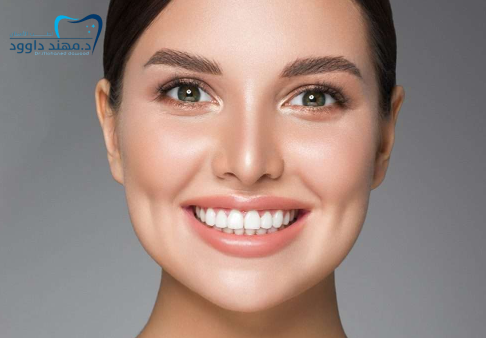 أفضل عيادة لابتسامة هوليود من خلال تبييض الأسنان: 0545378843