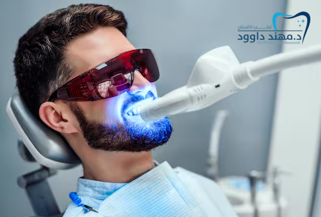 افضل عيادة في السعودية لتبييض الأسنان بالليزر: 0545378843