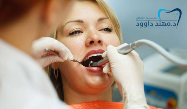 حشوات تجميلية لسد فراغات الأسنان وتحسين ابتسامتك: 0545378843