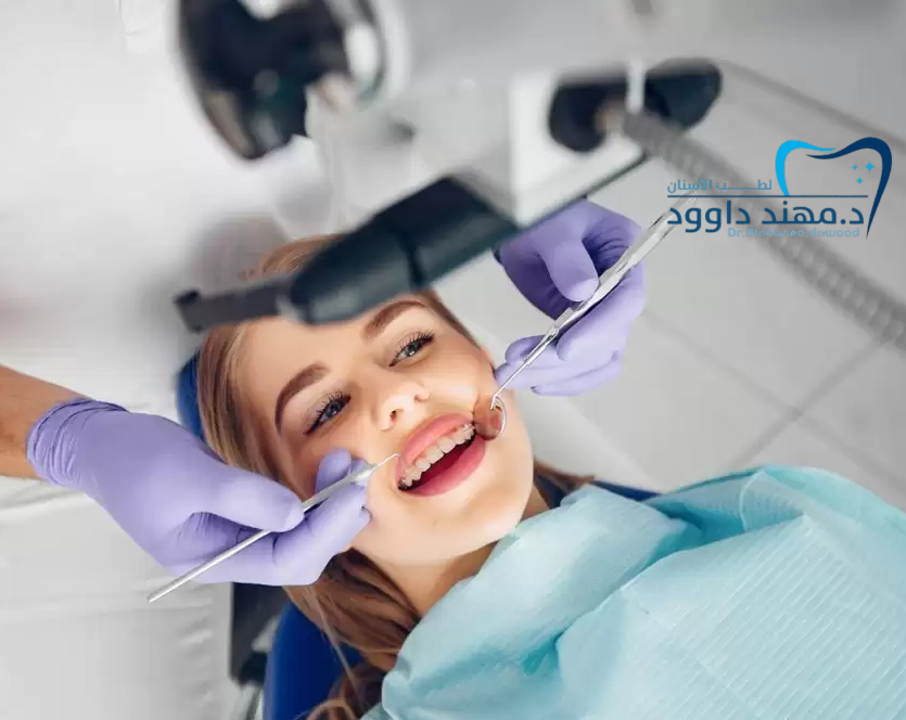 هوليود سمايل 2025, سعر ابتسامة هوليود, انواع ابتسامة هوليود: 0545378843
