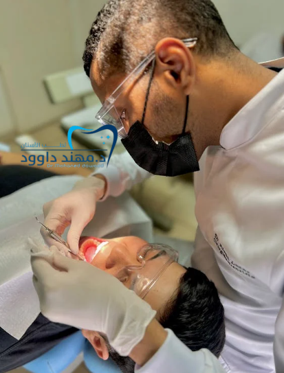 حشوة تجميلية للسن الامامي - عيادة الدكتور داوود: 0545378843