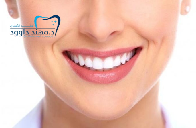 اشكال ابتسامة هوليود للبنات