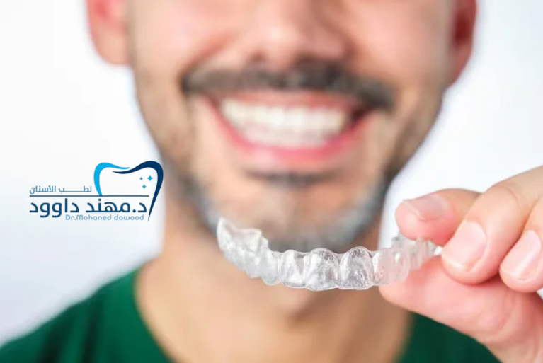 سعر قوالب تبييض الاسنان في العيادات: 0545378843