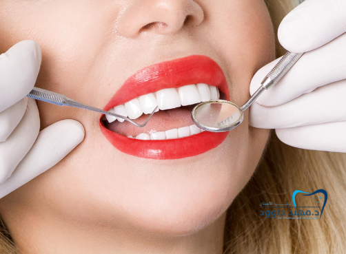 اشكال ابتسامة هوليود: 0545378843