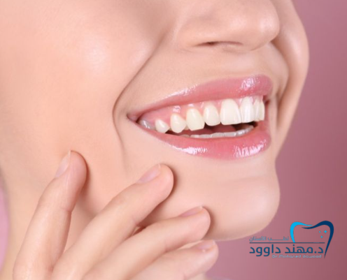 كم سعر ابتسامة هوليود في الرياض 2026: 0545378843