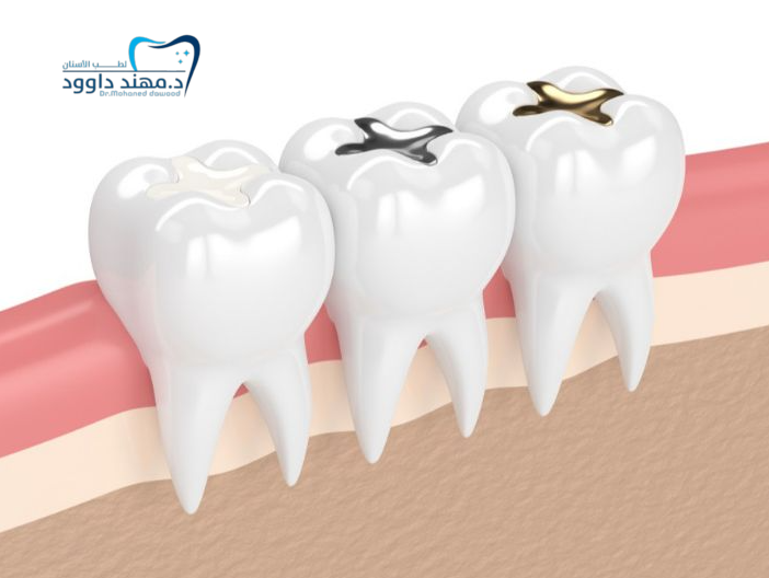 كيف أبيض الحشوة التجميلية: 0545378843