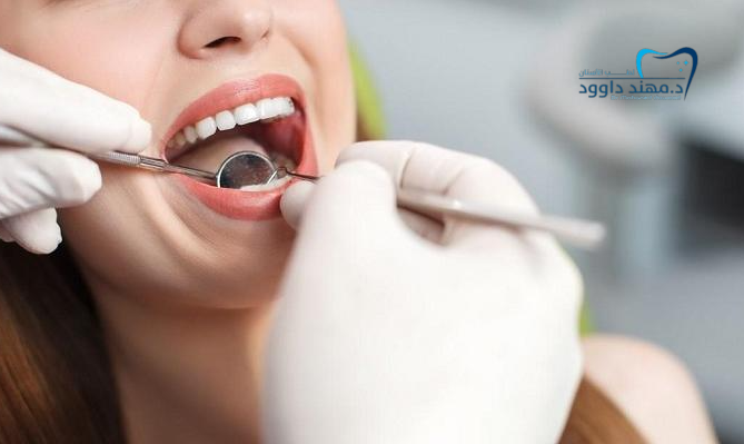 تكلفة زراعة الأسنان: 0545378843