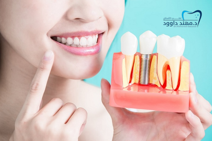 ابتسامتك عنوان جمالك – اكتشف ابتسامة المشاهير في أفضل عيادة بالرياض: 0566186262