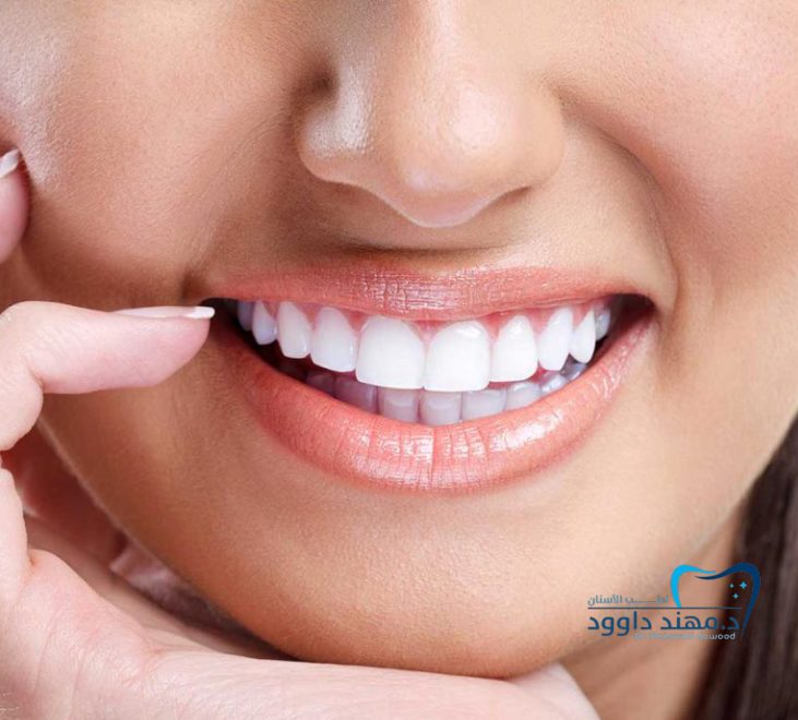 خطوات الحصول على ابتسامة هوليود في الرياض من البداية للنهاية: 0545699624