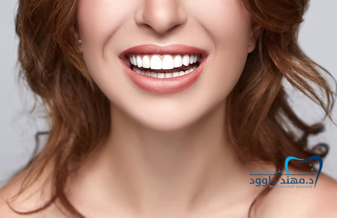 خطوات الحصول على ابتسامة المشاهير: كل ما تحتاج معرفته: 0545378843