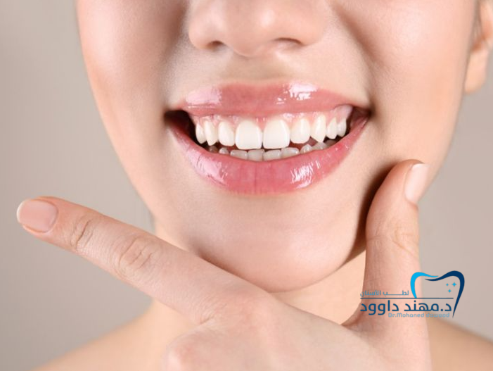 اشكال ابتسامة هوليود للبنات: 0545378843