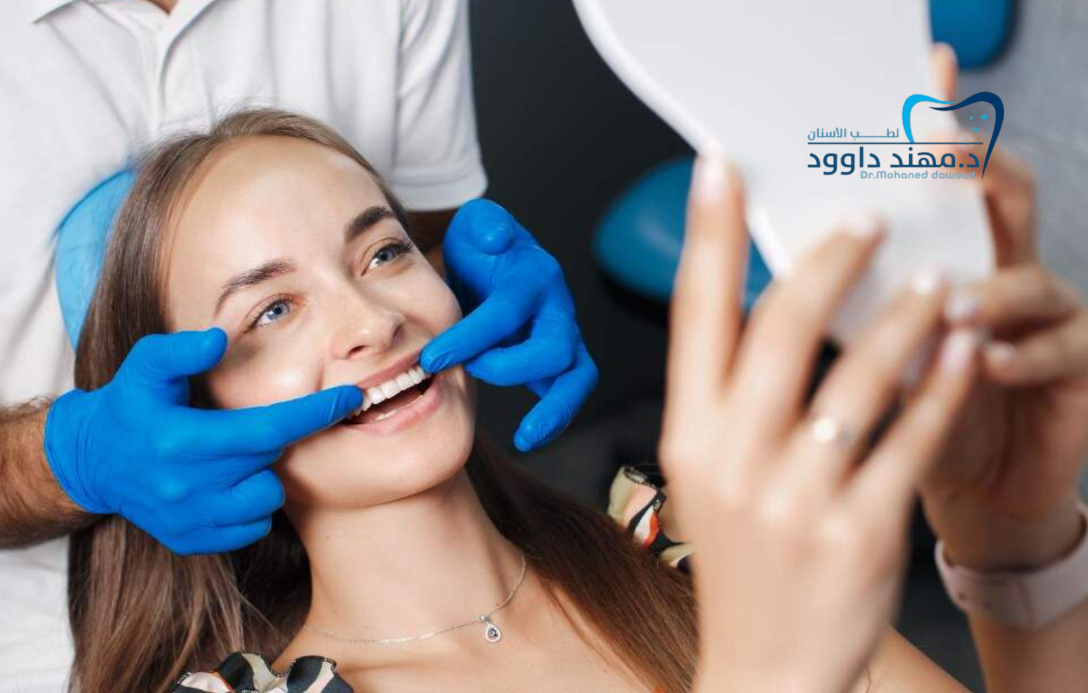ما هي ابتسامة هوليود؟ وما خطوات الحصول عليها: 0545378843