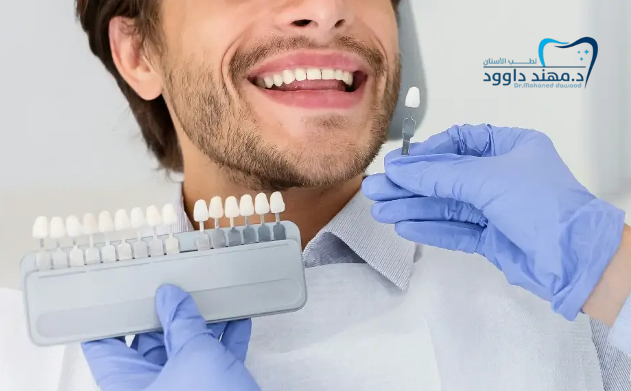 خطوات الحصول على ابتسامة المشاهير: كل ما تحتاج معرفته: 0545378843