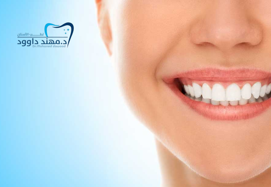 ابتسامة هوليود في الرياض بأسعار معقولة: 0545699624