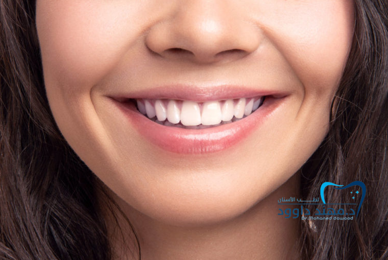 ما هي ابتسامة هوليود 3D وما الذي يميزها: 0545378843