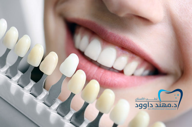 أفضل عيادة أسنان في الرياض: تركيب ابتسامة هوليود المتحركة: 0545699624