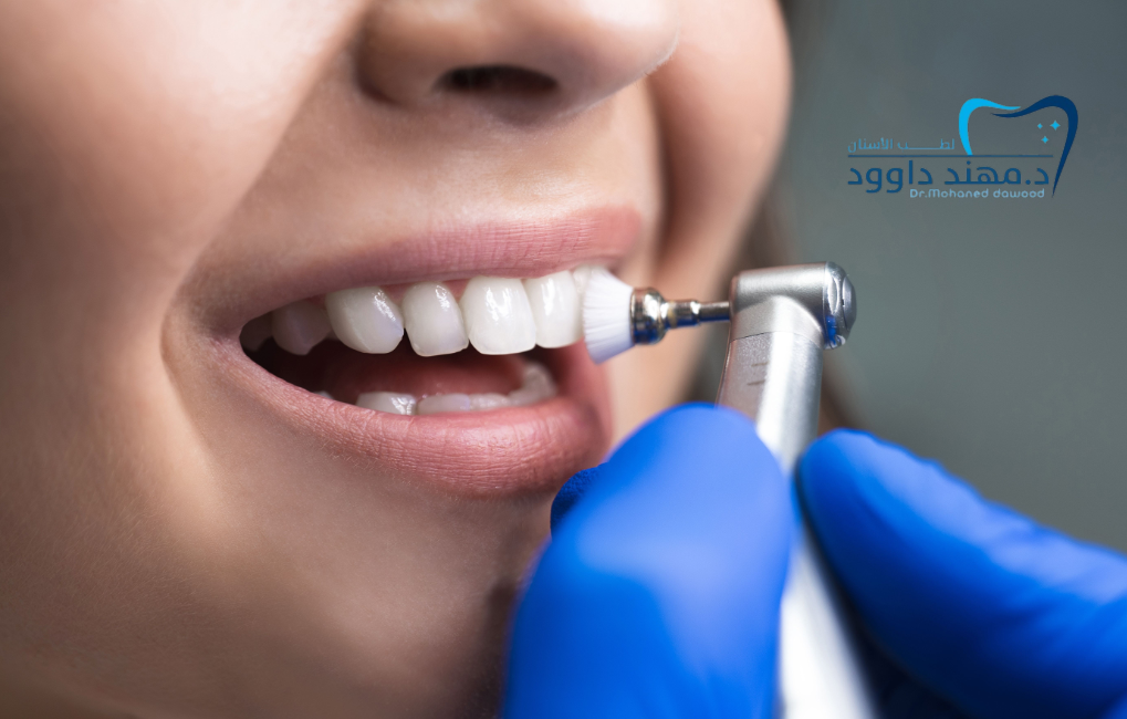 مركز تجميل أسنان في الرياض قريب مني: 0545378843