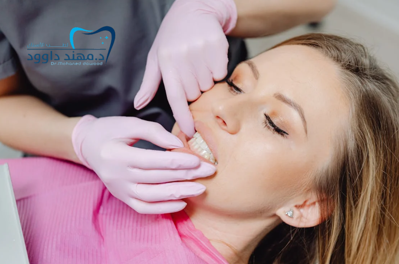 تقنية تبييض الأسنان لابتسامة هوليود: 0545699624