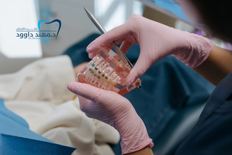 ما هي ابتسامة هوليود؟ وهل تستحق التجربة في السعودية: 0545699624