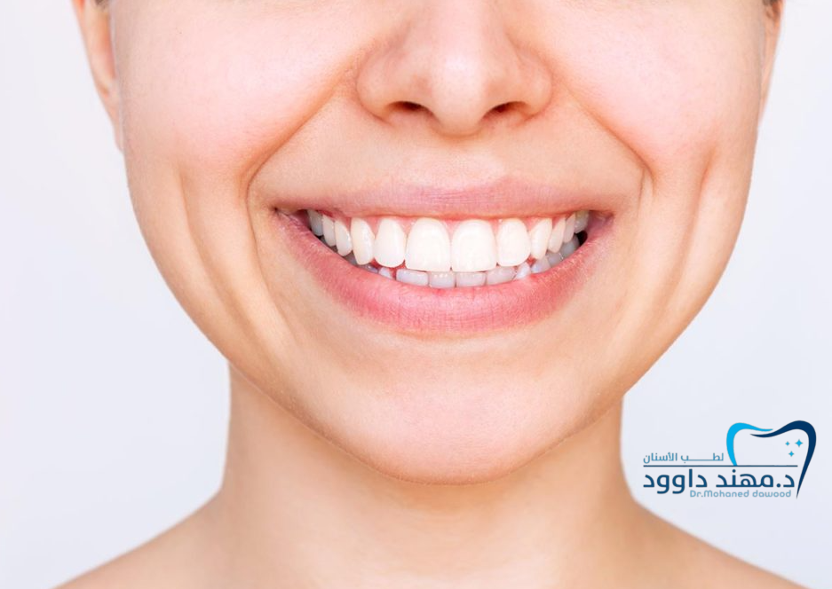 احصل على ابتسامة المشاهير في عيادة تجميل أسنان بالرياض: 0566186262