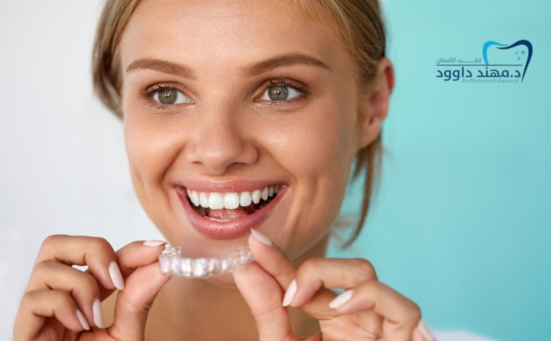 دليلك لأسعار قوالب تبييض الأسنان في الرياض 2025 + تجربتي الشخصية: 0545699624