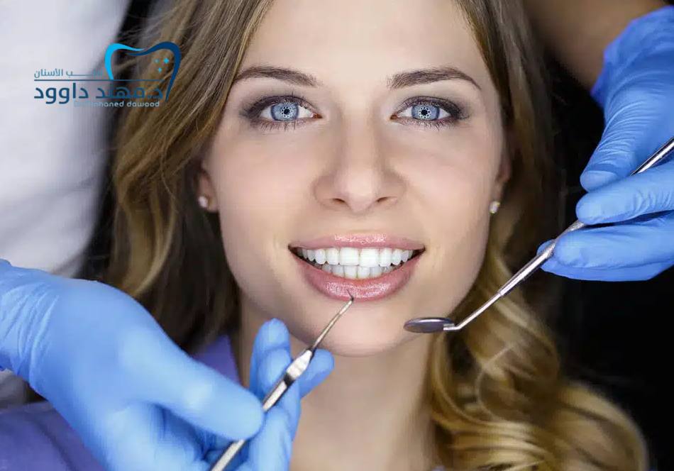 دليل شامل عن أفضل عدسات الأسنان التجميلية 2025: احصل على ابتسامة هوليود: 0545699624