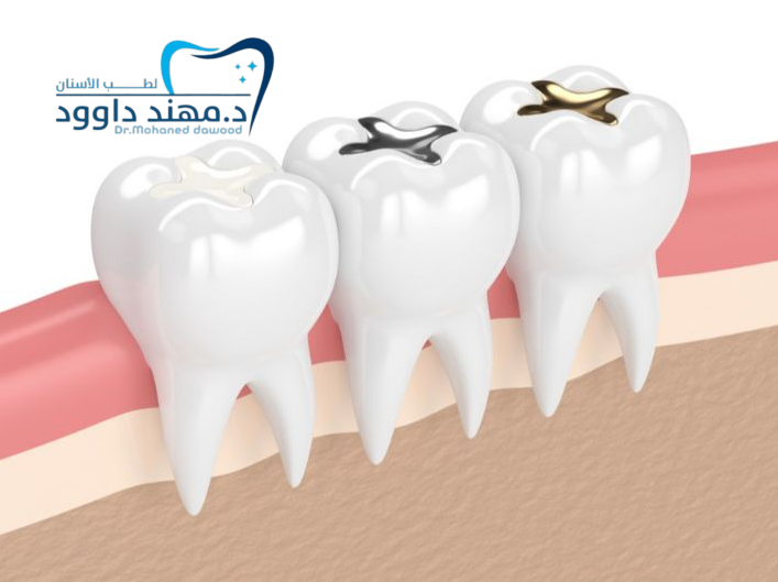 تعرف على سعر الحشوات التجميلية لسد الفراغات: 0545699624