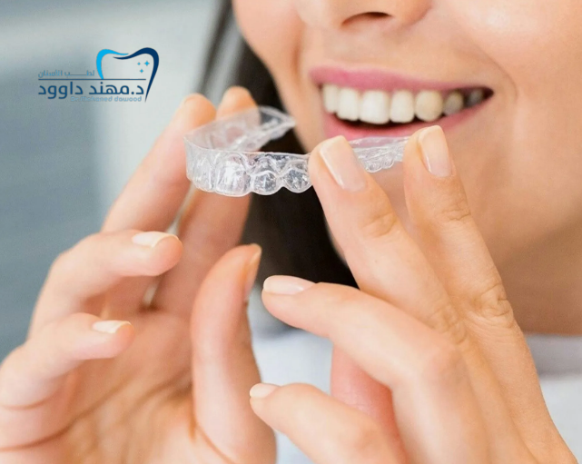 دليلك لأسعار قوالب تبييض الأسنان في الرياض 2025 + تجربتي الشخصية: 0545699624