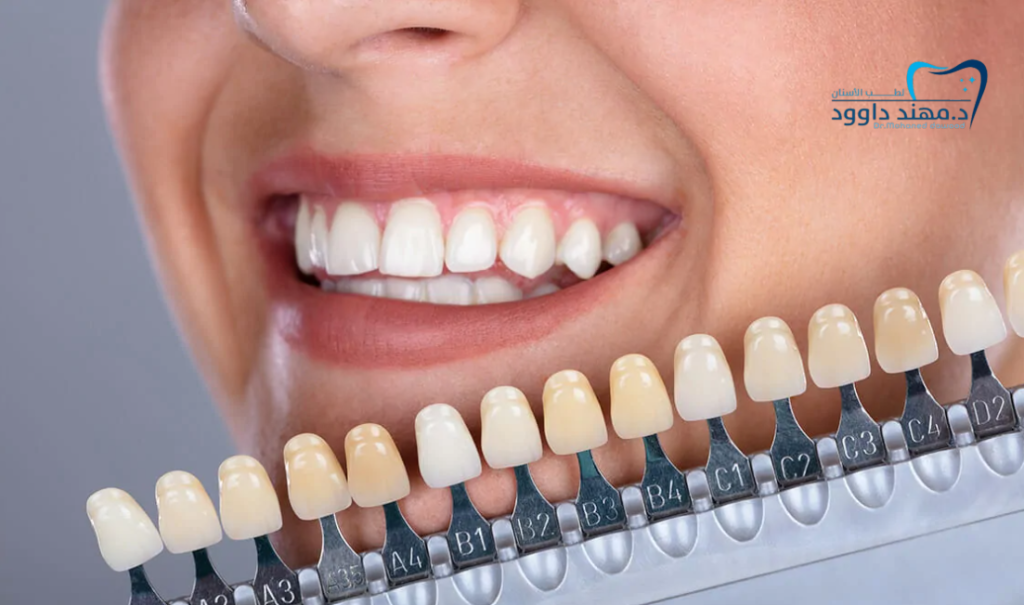 تقويم وزراعة وتجميل الأسنان في الرياض: 0545378843