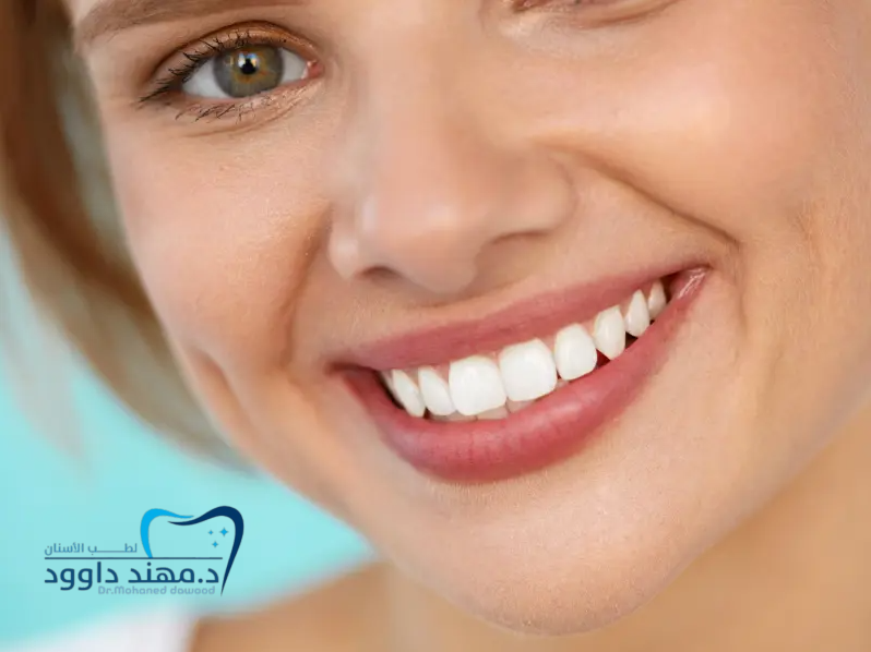ابتسامة هوليود في الرياض: كم التكلفة وما أفضل العيادات: 0545699624