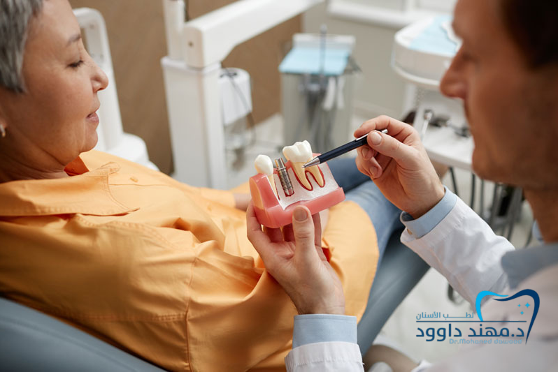 زراعة الأسنان في الرياض: الأسعار، الأنواع، وأفضل العيادات 2025: 0545699624