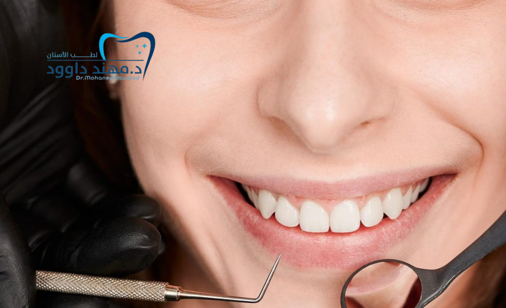 احصل على ابتسامة النجوم: ابتسامة هوليود خطوة بخطوة: 0545699624