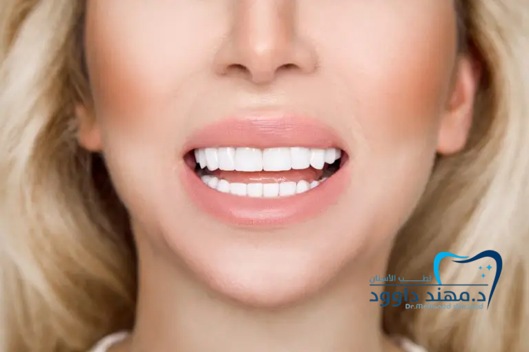 وين أحصل تبييض أسنان احترافي في الرياض: 0566186262