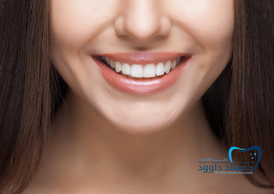 خدمات ابتسامة هوليود في عيادة د. مهند داوود - تقنيات متطورة ونتائج مضمونة: 0545699624