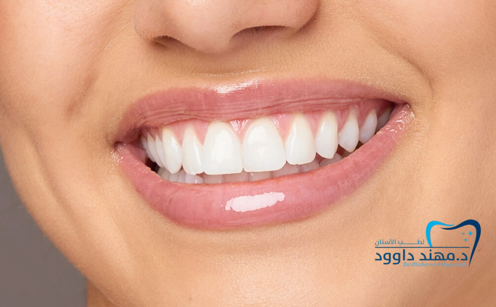 ابتسامة هوليود المشاهير في السعودية: 0545699624