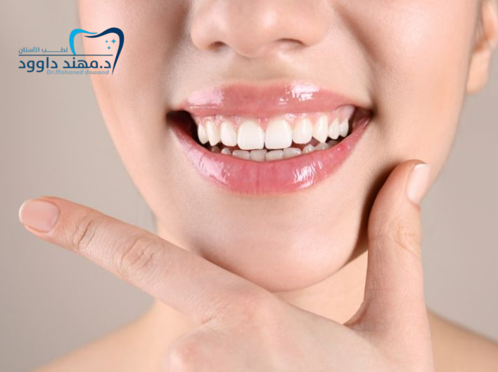 كم تدوم ابتسامة هوليود؟ ونصائح للحفاظ عليها سنوات طويلة: 0545378843