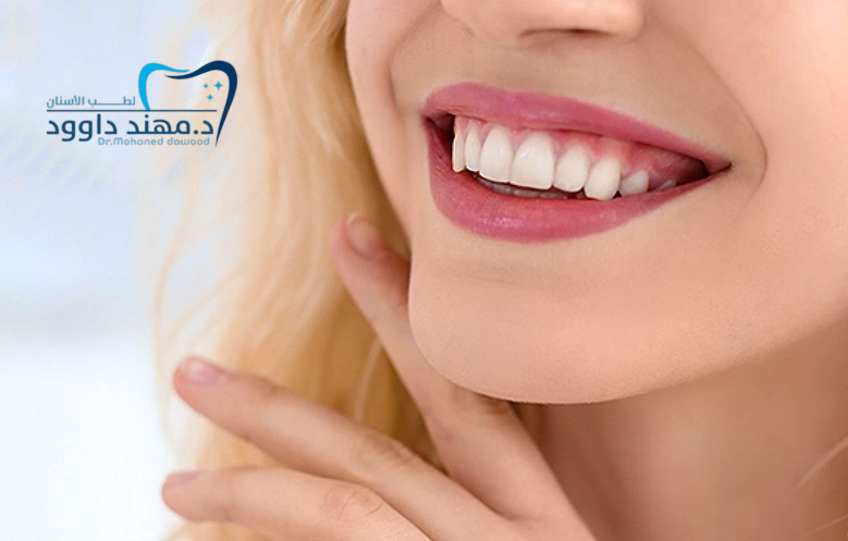 احصل على ابتسامة المشاهير في عيادة تجميل أسنان بالرياض: 0566186262