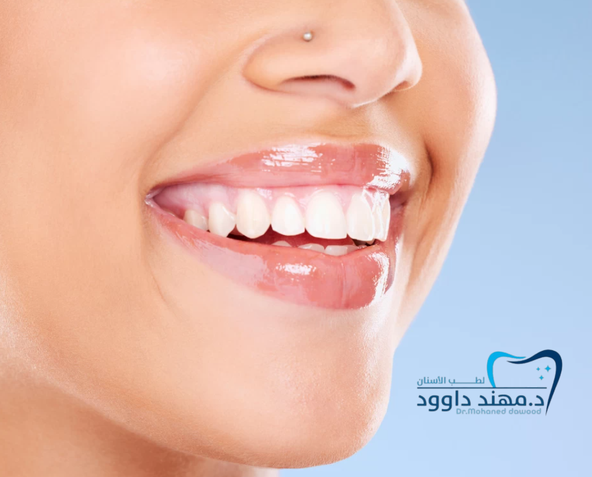 أفضل دكتور عدسات وتركيبات أسنان في الرياض 2026: 0545378843