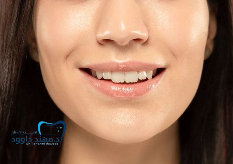 هل نتائج ابتسامة هوليود دائمة: 0545699624