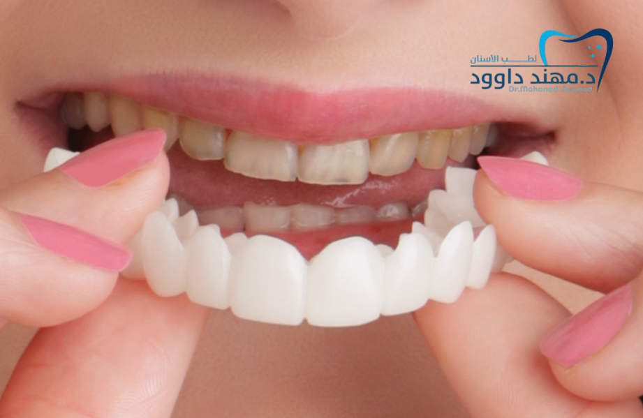 تقويم وزراعة وتجميل الأسنان في الرياض: 0545378843