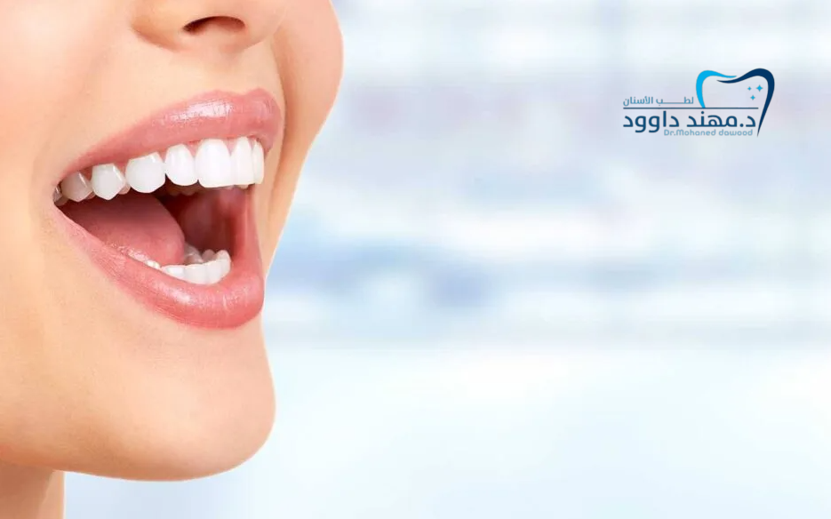تجميل الأسنان وابتسامة هوليود في السعودية: 0545378843