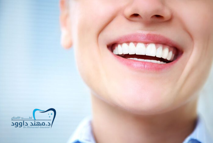 افضل دكتور تبييض أسنان بالرياض 2025 – د.مهند: 0545378843