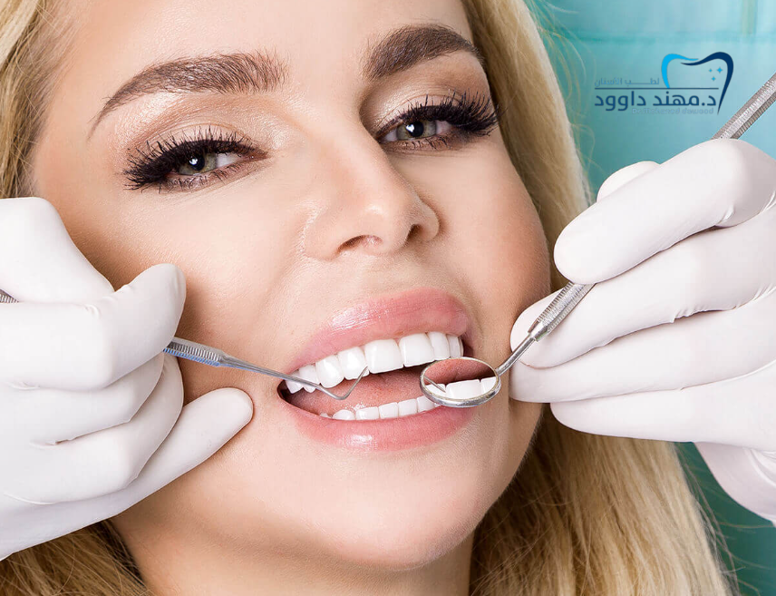 تكلفة الفينير في السعودية: 0545699624