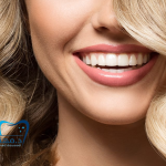 خطوات تركيب قشرة الأسنان للحصول على ابتسامة هوليود في أقل من أسبوع: 0545699624