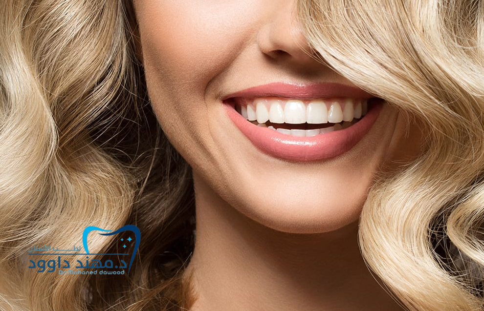 خطوات تركيب قشرة الأسنان للحصول على ابتسامة هوليود في أقل من أسبوع: 0545699624
