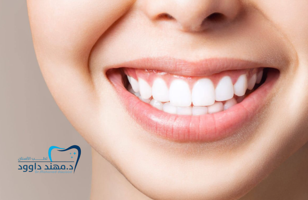 ابتسامة هوليود المتحركة: سعرها، شكلها، وهل تستحق التجربة: 0545699624