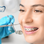 أسعار تقويم الأسنان في الرياض 2025 – كل ما تحتاج معرفته: 0566186262
