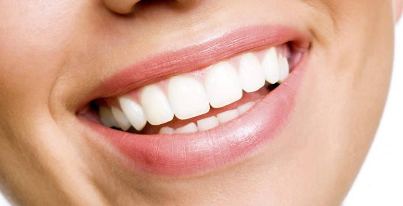 تلميع الاسنان قبل وبعد