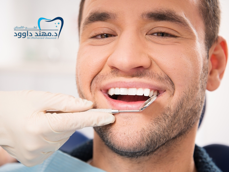 افضل عيادة فينير الأسنان في الرياض: 0566186262