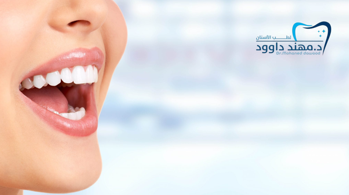 أفضل أطباء ابتسامة هوليود في الرياض: 0545378843